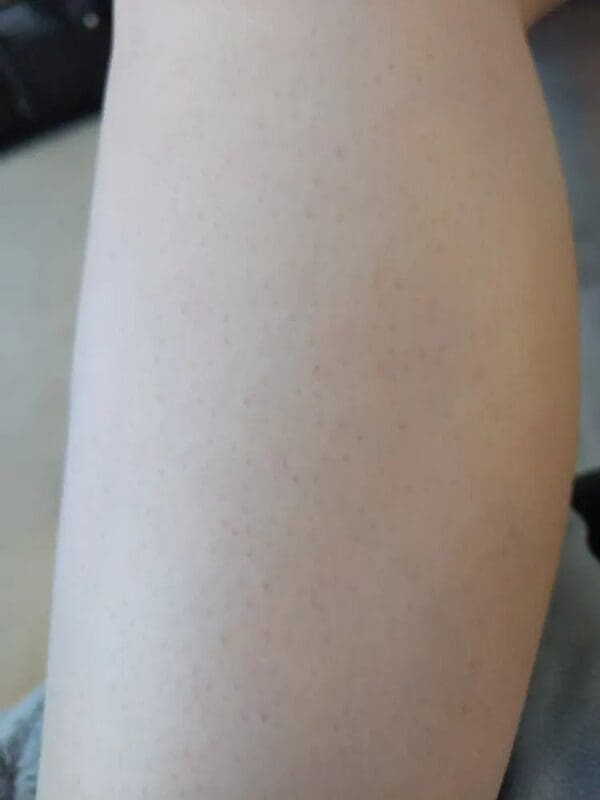 Image #1 from Rubaiya