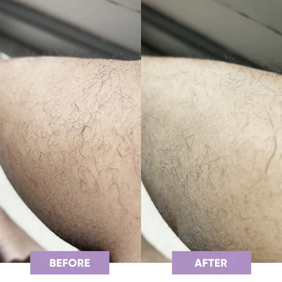 Product After Before review Image