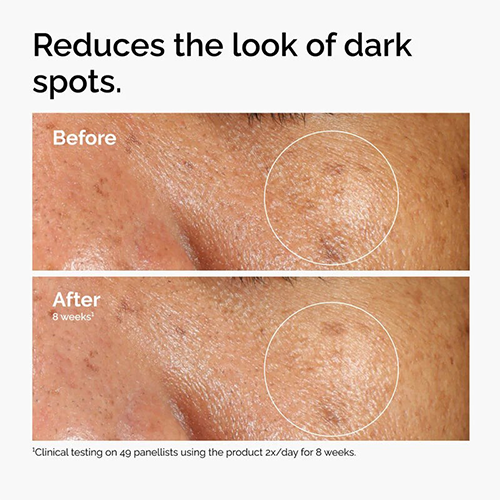 The Ordinary Alpha Arbutin 2% + Ha Serum 30ml