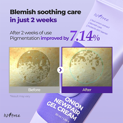 Onion Newpair Gel Cream