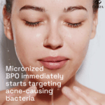 Cetaphil Gentle Clear Complexion Clearing Acne Cleanser 124ml